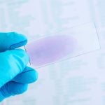 USF Health Researchers Discover New Malaria Vaccine Target