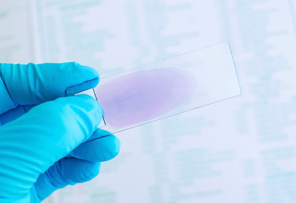USF Health Researchers Discover New Malaria Vaccine Target