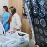 Stroke Rates Are Rising in Young Adults—Experts Reveal How To Cut Risk - Newsweek